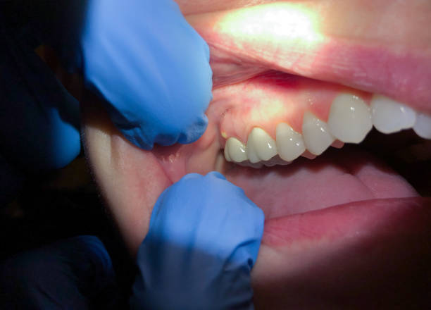 Best Emergency Tooth Extraction  in Monterey, TN