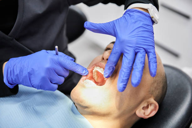 Best Emergency Gum Pain Relief  in Monterey, TN